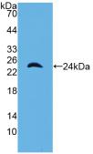 Polyclonal Antibody to Alpha-1-Microglobulin (a1M)