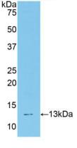 Polyclonal Antibody to Transcription factor 20 (TCF20)