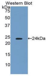 Polyclonal Antibody to Interferon Beta (IFNb)