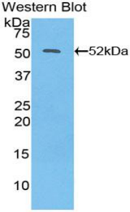 Polyclonal Antibody to Interferon Beta (IFNb)