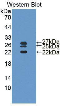 PAA223Hu06.jpg