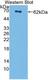 Polyclonal Antibody to Centromere Protein I (CENPI)