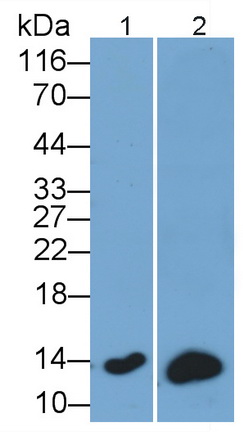 Polyclonal Antibody to Beta-2-Microglobulin (b2M)