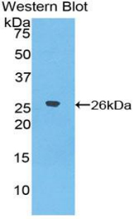 PAA262Hu02.jpg