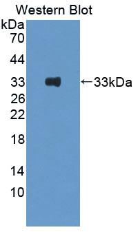 Polyclonal Antibody to Linker For Activation Of T-Cell (LAT)