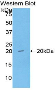 Polyclonal Antibody to Centromere Protein E (CENPE)