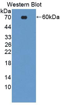 Polyclonal Antibody to B-Cell Activation Factor Receptor (BAFFR)