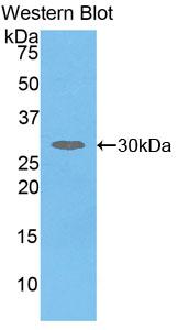 PAA284Hu01.jpg