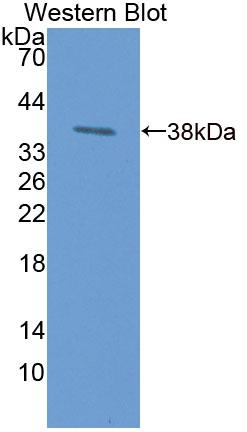 PAA296Hu01.jpg