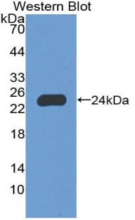 Polyclonal Antibody to Neutrophil Cytosolic Factor 2 (NCF2)