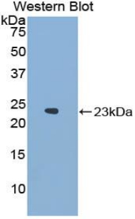 Polyclonal Antibody to Neutrophil Cytosolic Factor 2 (NCF2)