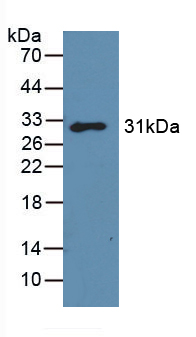 Polyclonal Antibody to Galectin 3 (GAL3)