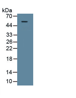 Polyclonal Antibody to Galectin 9 (GAL9)