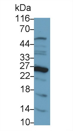 PAA314Hu01.jpg