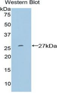 Polyclonal Antibody to Sp100 Nuclear Antigen (Sp100)