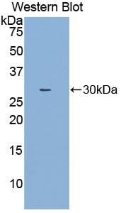 PAA330Hu01.jpg