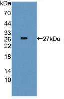 Polyclonal Antibody to Thyroglobulin (TG)