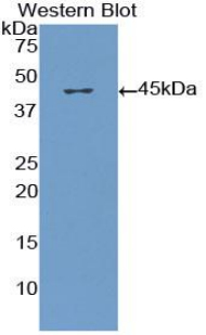 Polyclonal Antibody to Chemokine (C-X-C motif) ligand 7 ( CXCL7)