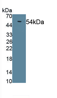 Polyclonal Antibody to Lipoprotein lipase (LPL)