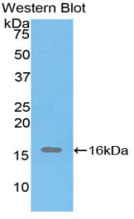 Polyclonal Antibody to Inhibin Alpha (INHa)