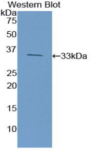 Polyclonal Antibody to High Mobility Group Protein 1 (HMGB1)