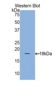 Polyclonal Antibody to Retinol Binding Protein 1, Cellular (RBP1)