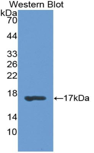 Polyclonal Antibody to Retinol Binding Protein 1, Cellular (RBP1)