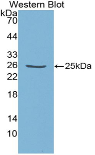 PAA415Hu01.jpg