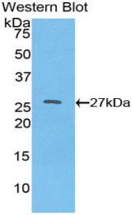 Polyclonal Antibody to Hepatocyte Nuclear Factor 4 Alpha (HNF4a)