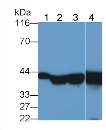 PAA425Mi08.jpg