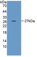 Polyclonal Antibody to Cluster Of Differentiation 55 (CD55)