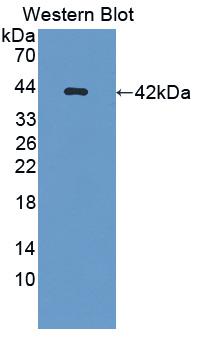 Polyclonal Antibody to Osteocalcin (OC)