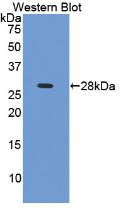 Polyclonal Antibody to Cardiac Troponin I (cTnI)