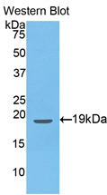 Polyclonal Antibody to Endothelin 1 (EDN1)