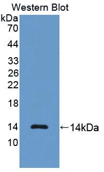 Polyclonal Antibody to N-Terminal Pro-Brain Natriuretic Peptide (NT-ProBNP)