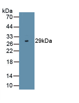 Polyclonal Antibody to N-Terminal Pro-Brain Natriuretic Peptide (NT-ProBNP)