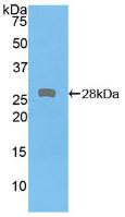 Polyclonal Antibody to Protein Kinase D2 (PKD2)