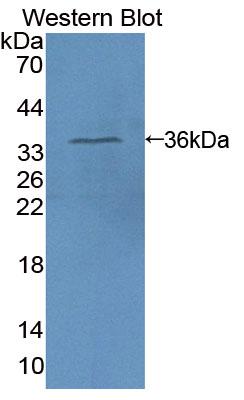 PAA515Hu01.jpg