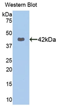 Polyclonal Antibody to Cytokeratin 16 (CK16)