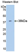 PAA517Hu02.jpg