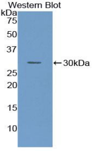 Polyclonal Antibody to Tissue Factor (TF)