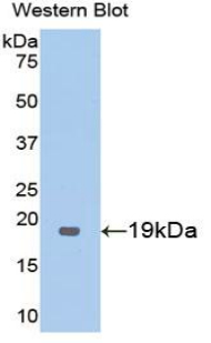 Polyclonal Antibody to Thrombomodulin (TM)