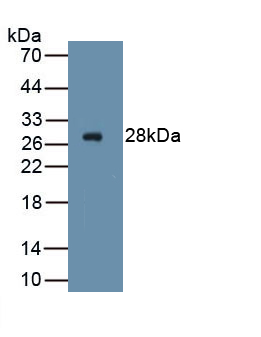 PAA534Hu01.jpg