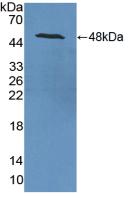 Polyclonal Antibody to Enolase, Neuron Specific (NSE)