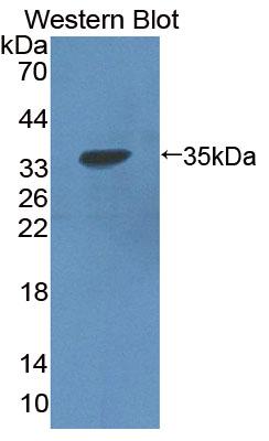 PAA539Hu06.jpg