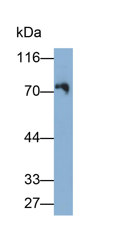 Polyclonal Antibody to Immunoglobulin M (IgM)