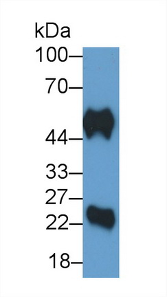 Polyclonal Antibody to Immunoglobulin G (IgG)