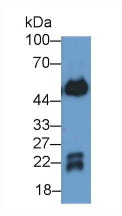 Polyclonal Antibody to Immunoglobulin G (IgG)