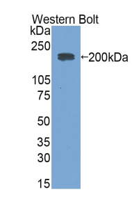 Polyclonal Antibody to Immunoglobulin E (IgE)