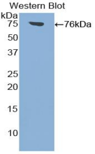 Polyclonal Antibody to Intercellular Adhesion Molecule 1 (ICAM1)